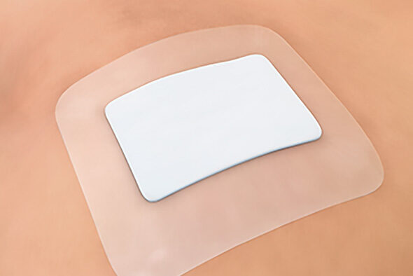 Sorbact Compress dressing secured to the skin with a covering dressing.