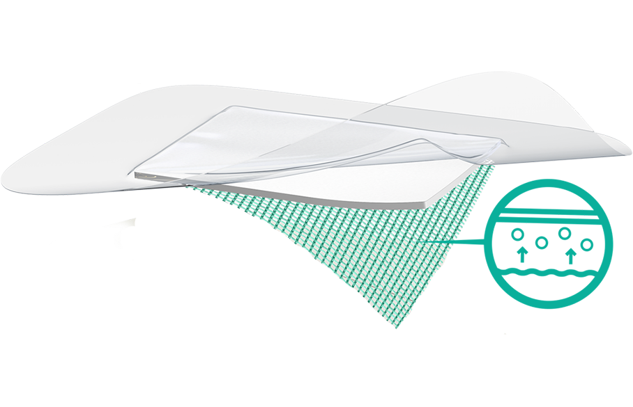Illustration showing bacteria attaching to the green surface of a Sorbact dressing.